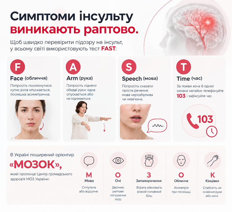 Перші ознаки інсульту: як розпізнати за 1 хвилину